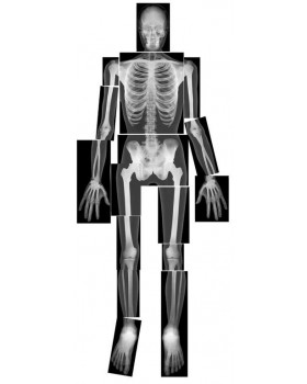 Emberi test röntgenlapja